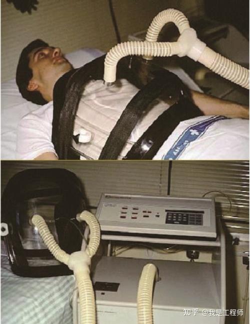 为什么没有电动气控呼吸机