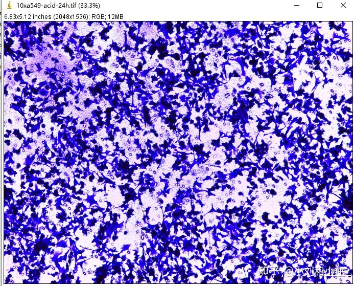零基础sci绘图13如何分析transwell穿过小室的细胞数量