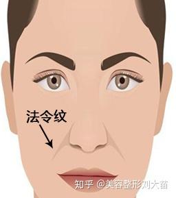 什么样子算鼻基底凹陷 v2-c3a7b4b9b5f1afe1a5818ef71ad91e39_b.jpg