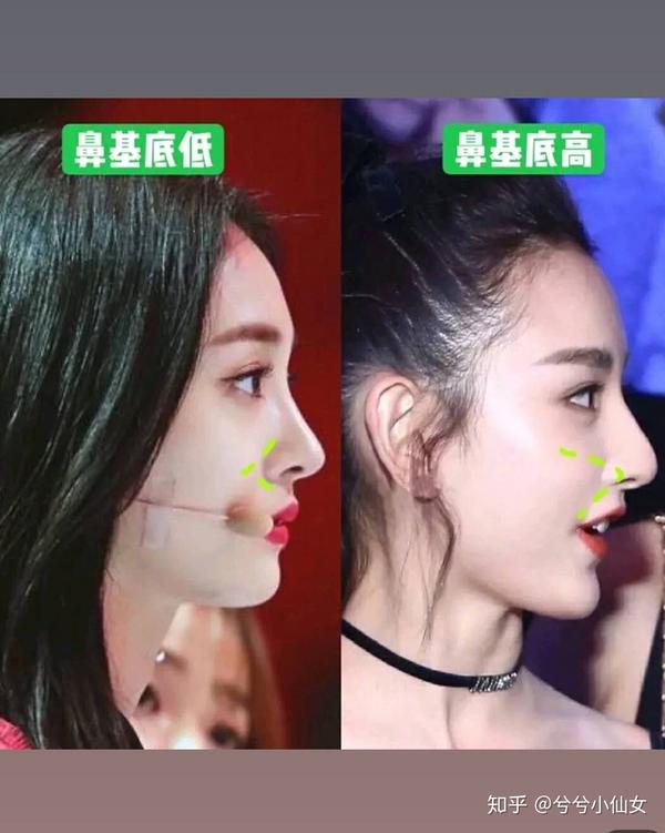 五官立体度跟鼻梁高度没有绝对关系
