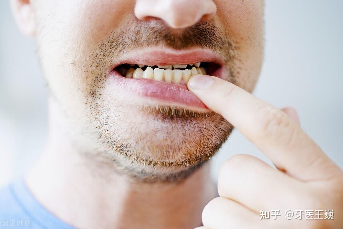牙齿上的烟渍怎么去除？_广州穗华口腔医院【官网】