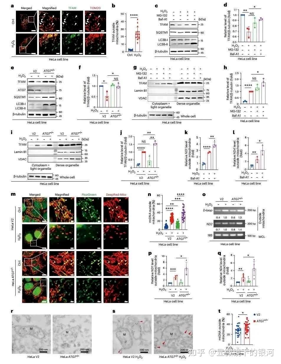 科学家揭示线粒体未折叠蛋白反应的关键信号机制 - 知乎
