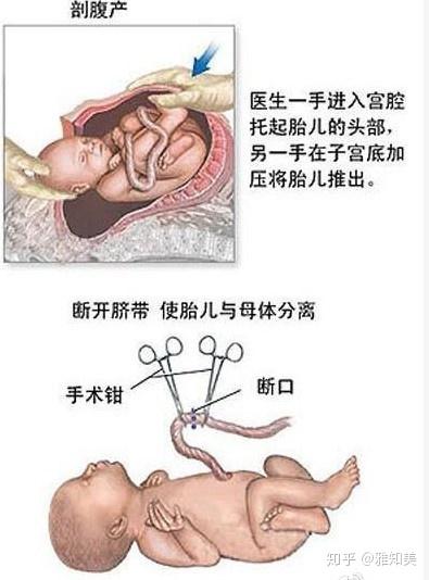 v2-c3cc9c07ea7aed0dcd86c46e6076c5c1_b.jpg