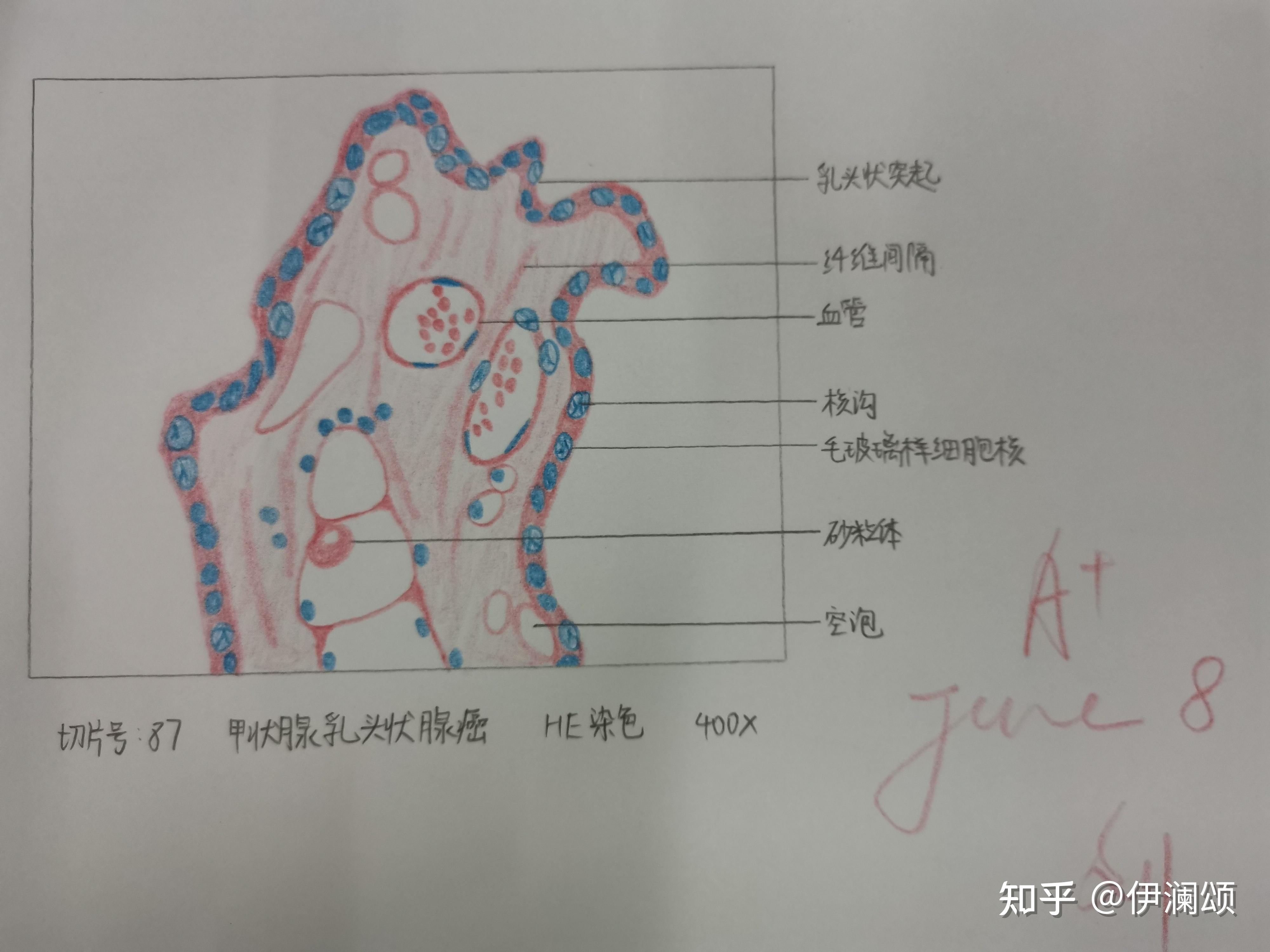 病理實驗紅藍鉛筆繪圖