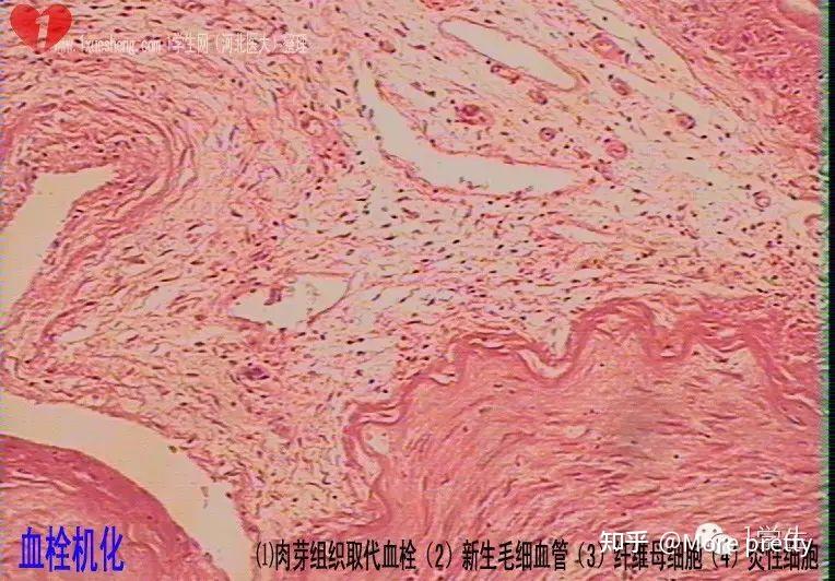 病理切片考试总结 - 知乎