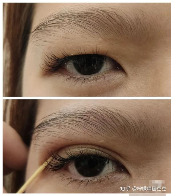 6但在双眼皮审美中,眉眼间距是指:眉毛到上睑缘的距离在相同