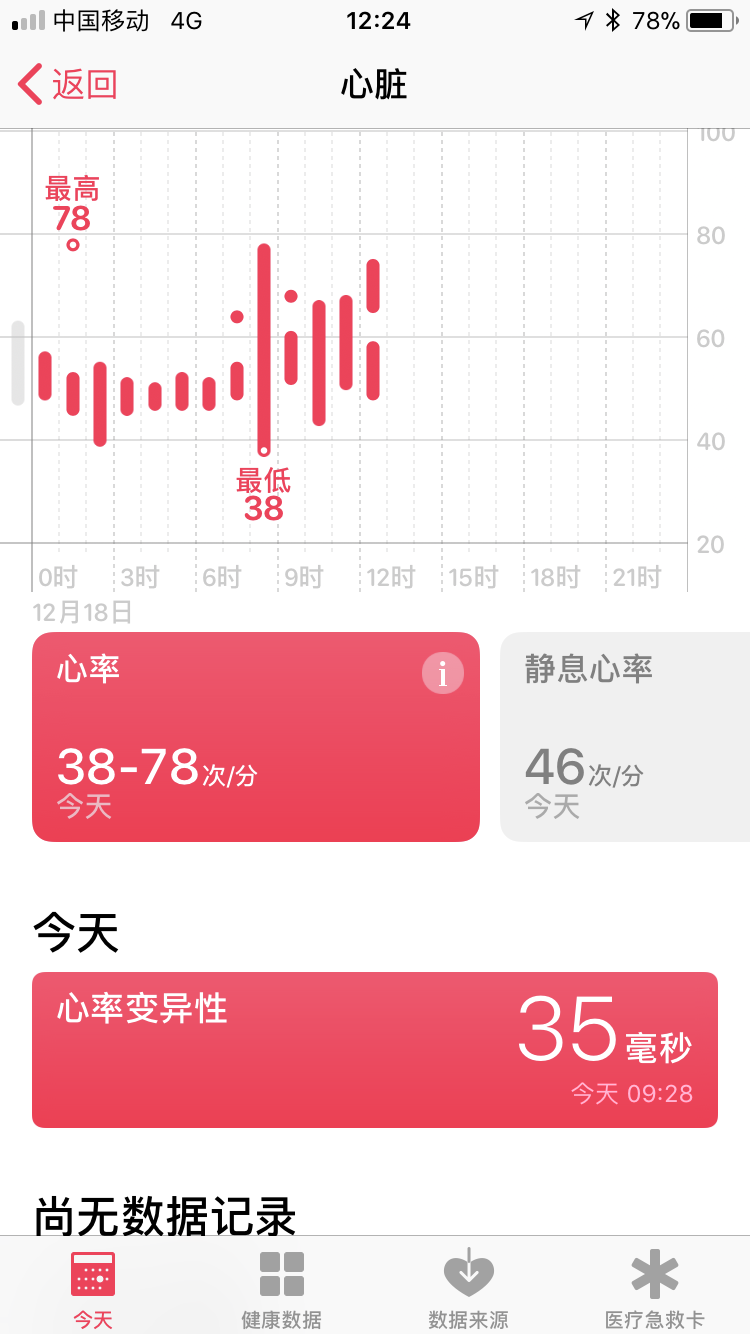 v2-c423415dbbe56fa66d8456d6742e3af7_r.jpg