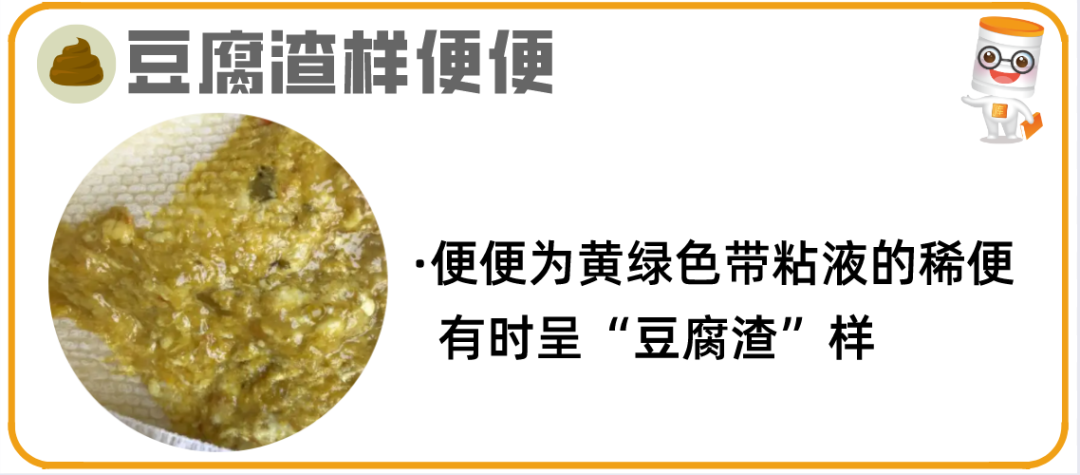 逾20种宝宝大便图片详解!最后10种必须警惕! - 知乎