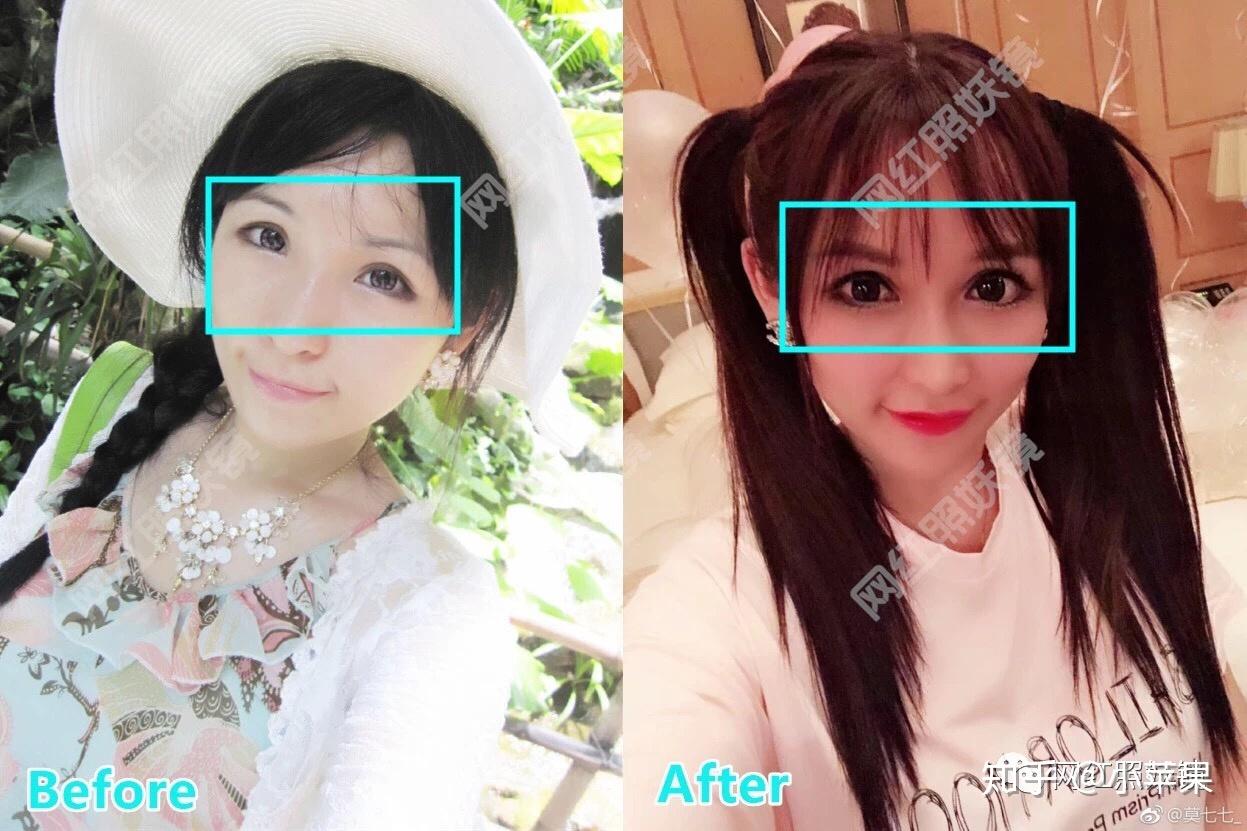 吃森米42天瘦20斤卖货半个月赚2000w这个三无微商究竟什么来头