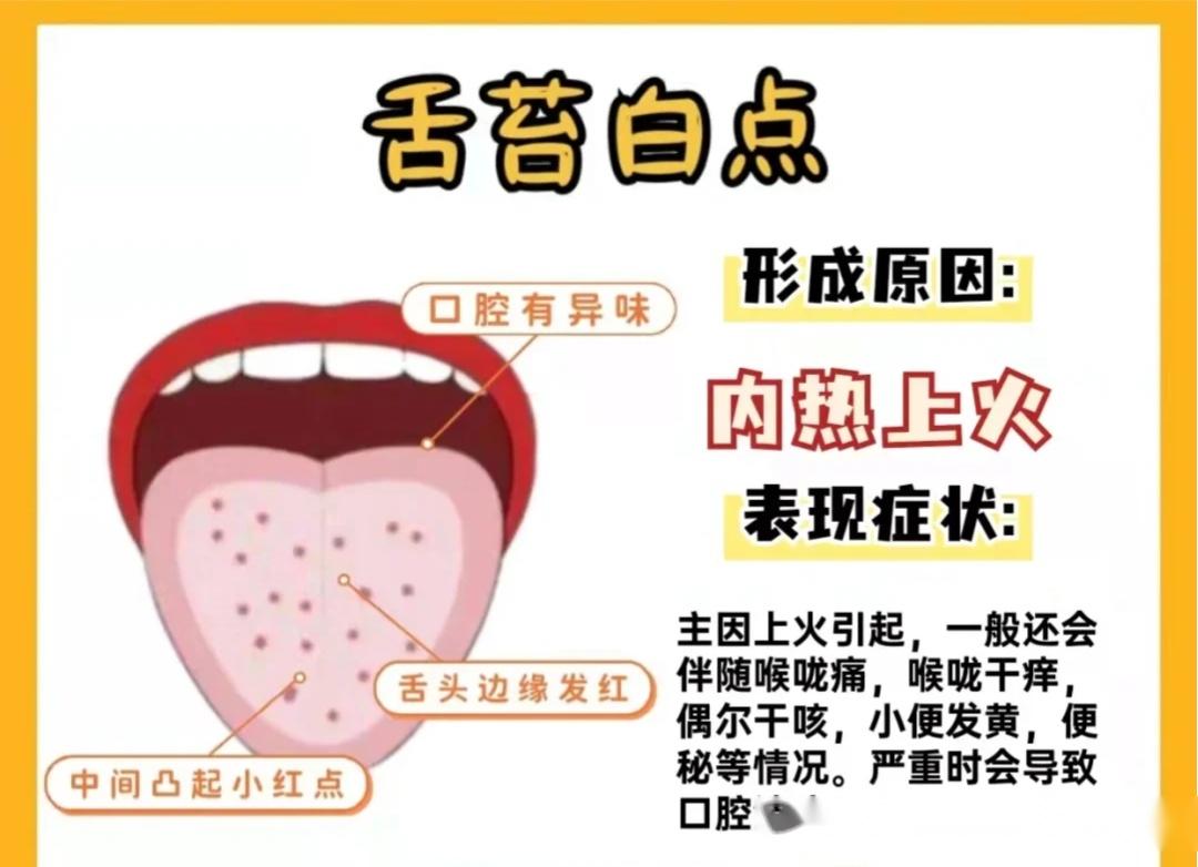 从舌苔看健康，跟中医学舌诊，这7种要注意-搜狐大视野-搜狐新闻