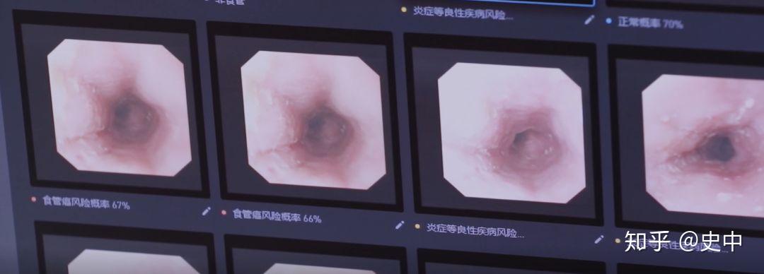 v2-c48af953e12e124c47512eb13f9f4be1_b.jpg 互联网巨头如何用医疗AI回答尊严与生命之问?