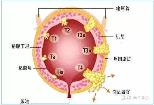 当医院诊断和保险公司认定不一致时