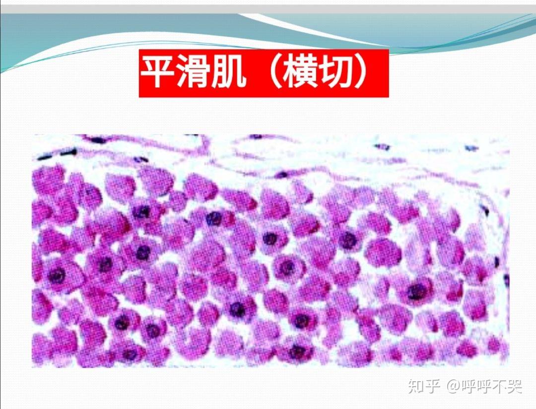 总觉的哪里怪怪的2平滑肌1血涂片