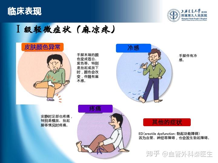 老年人腿脚发凉发麻需要警惕下肢动脉粥样硬化闭塞症