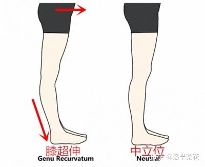 梨型身材怎么才能快速有效的减肥瘦腿?