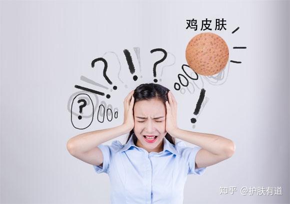 鸡皮肤可以打激光吗(激光打鸡皮肤会影响皮肤吗)