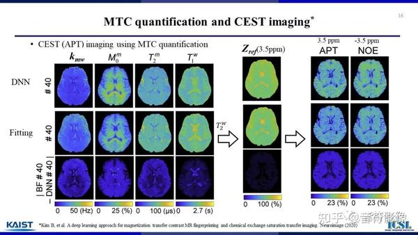 ISMRM新技术汇报：下一代CEST成像技术 - 知乎