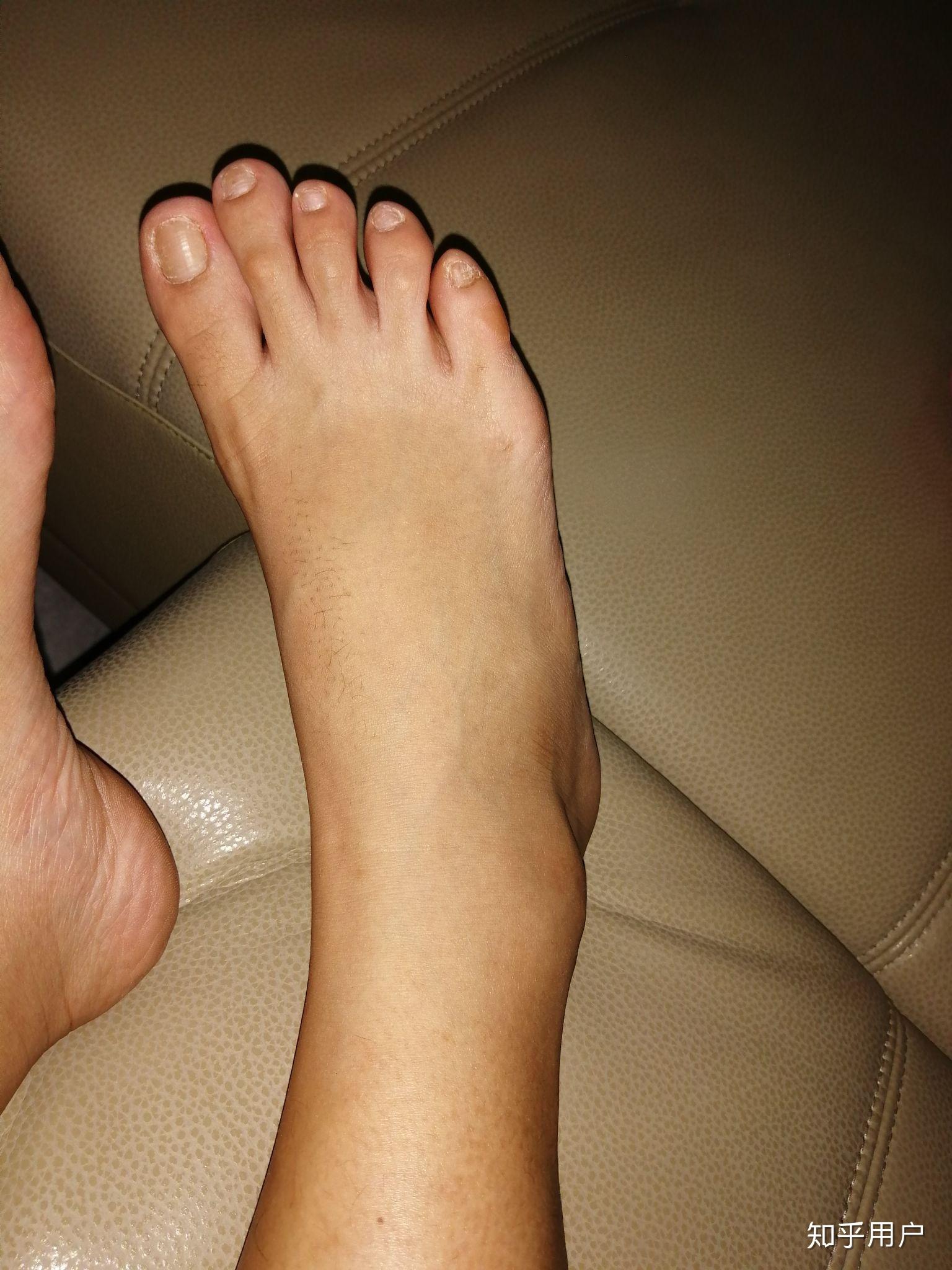 女生脚丑是种什么样的体验