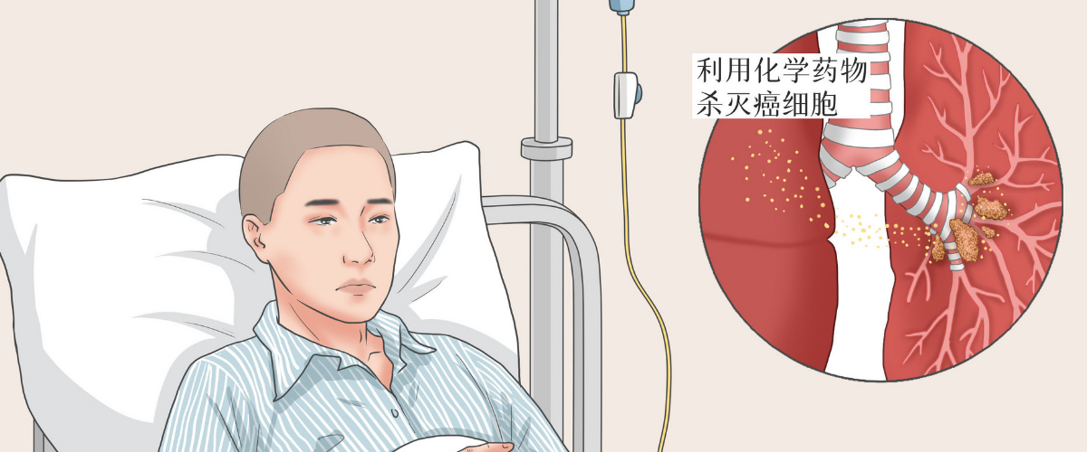 不懂胃癌化疗方案有哪些 看这篇就够了 知乎 不懂胃癌化疗方案有哪些 看这篇就够了 知乎