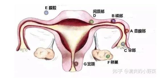 输卵管间质部图片