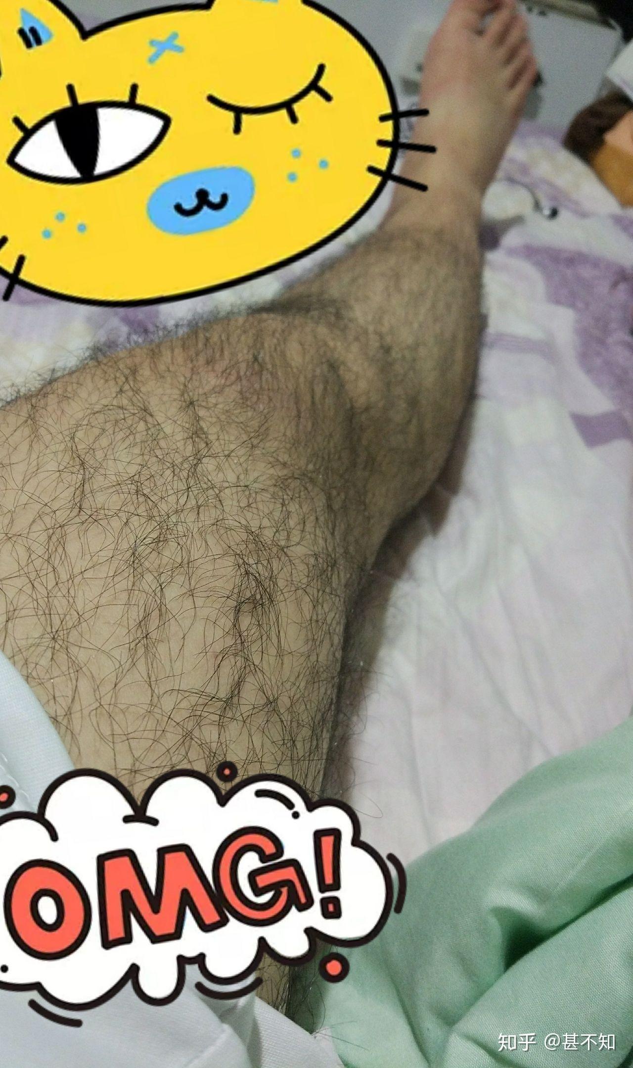 腿毛多是怎样一种体验?