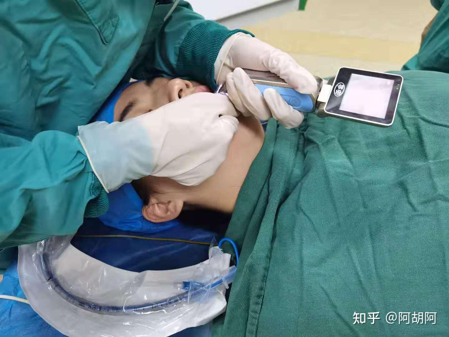 终于下定决心扁桃体术后心得及注意事项72