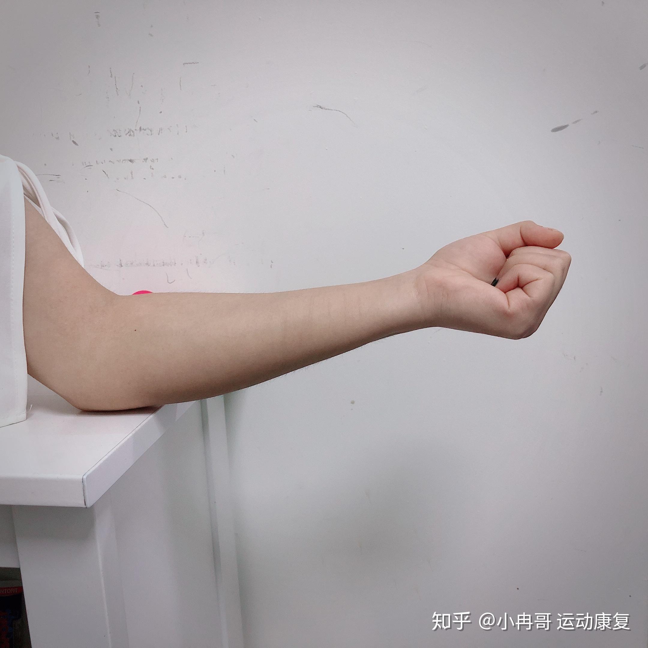 网球肘疼痛位置图片 v2-c5cada9c7265691d929f5af498f7be9f_r.jpg
