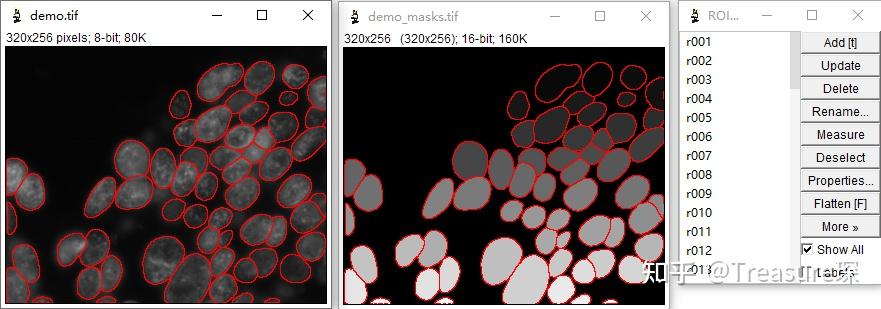 Cellpose-SAM —— 超人类水平的细胞分割 - 知乎