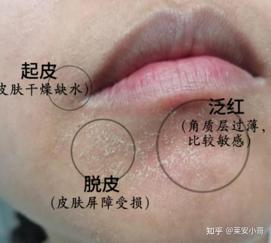 油皮控油水乳推荐_男士护肤品_男士水乳选择指南