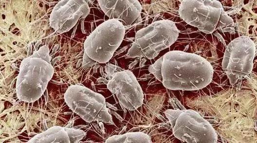 无处不在的螨虫真的可以被除螨吸尘器干掉吗