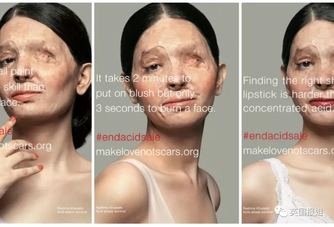 广东高校男生闯教室泼硫酸3名女孩烧伤毁容泼酸袭击为何屡禁不止