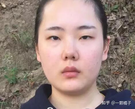 眼间距 zhuanlan.zhihu.com