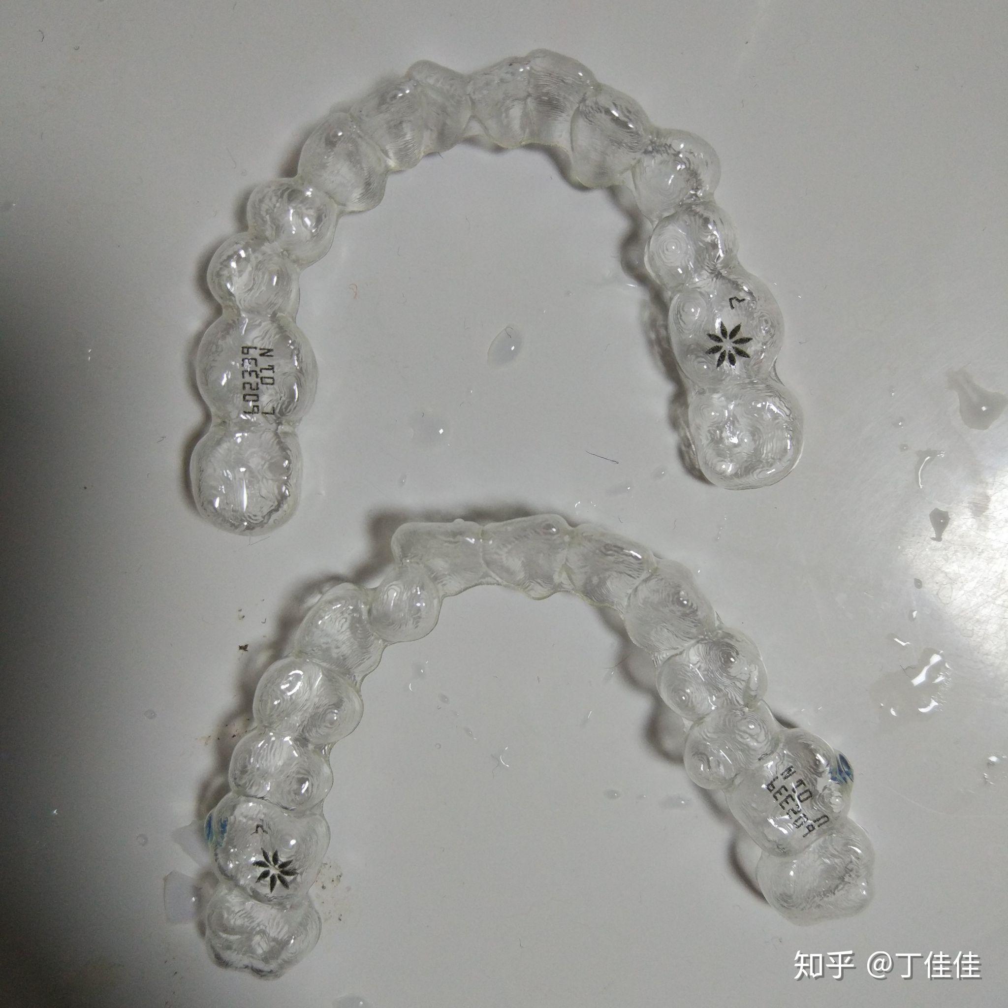 v2-c699edab596c639baa2fe679bdde992d_r.jpg