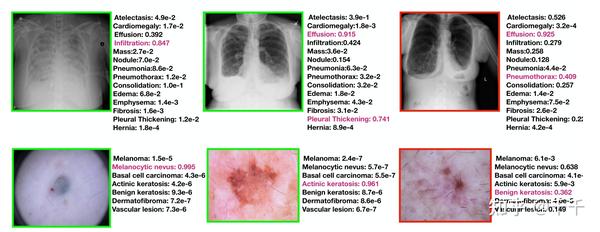 ACPL: Anti-curriculum Pseudo-labelling for Semi-supervised Medical ...