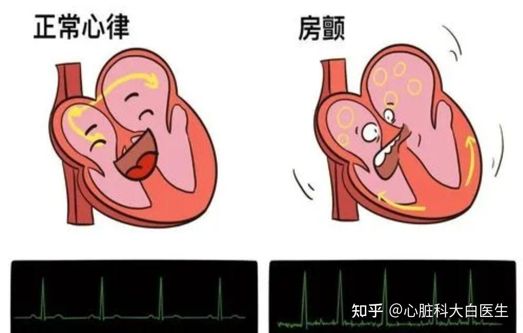 常見心律失常疾病,包括房早,室早,房速,室上速,室速,心動過緩等,都