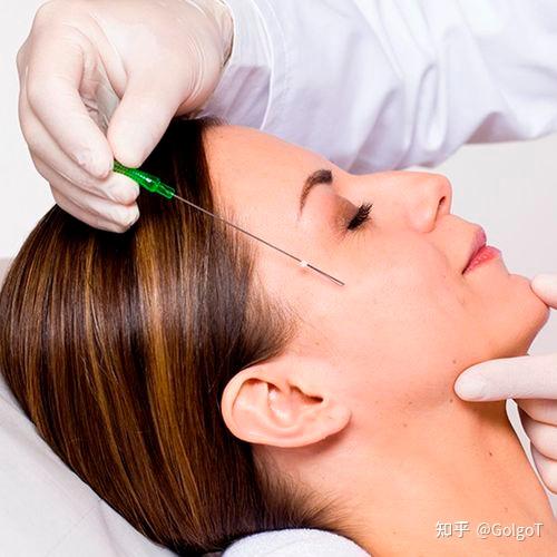 线雕提升:轻松实现紧致肌肤,重现年轻容颜 - 知乎