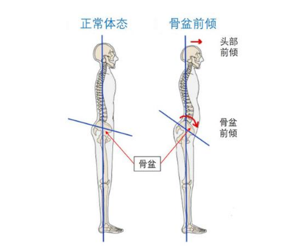 如何快速长高的6种方法 v2-c7949ecc6ab37827f16fd0d7faf2cb15_1440w.jpg