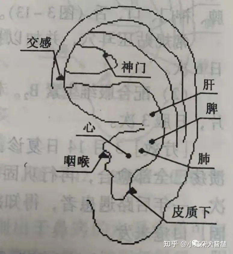 益康耳穴:什么是梅核气?中医耳穴如何治疗梅核气? - 知乎