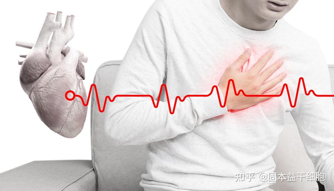 猝死的人都有的规律 - 知乎