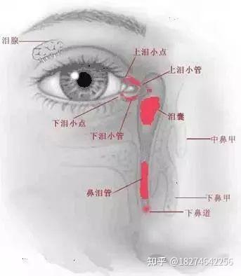 【眼健康科普课堂】“春风吹,眼泪流”,季节交替当心泪道发病 - 知乎