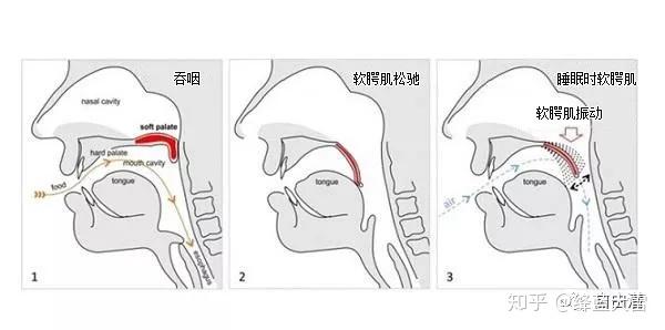 舌根佔舌的後1/3,以舌肌固定於舌骨和下頜骨等處,其位置幾乎呈垂直狀