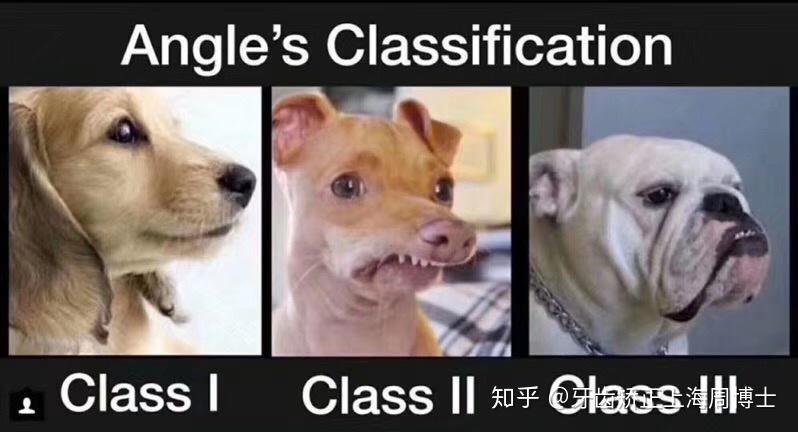v2-c84cd2371d6d011579f27f1f8008d739_r.jpg