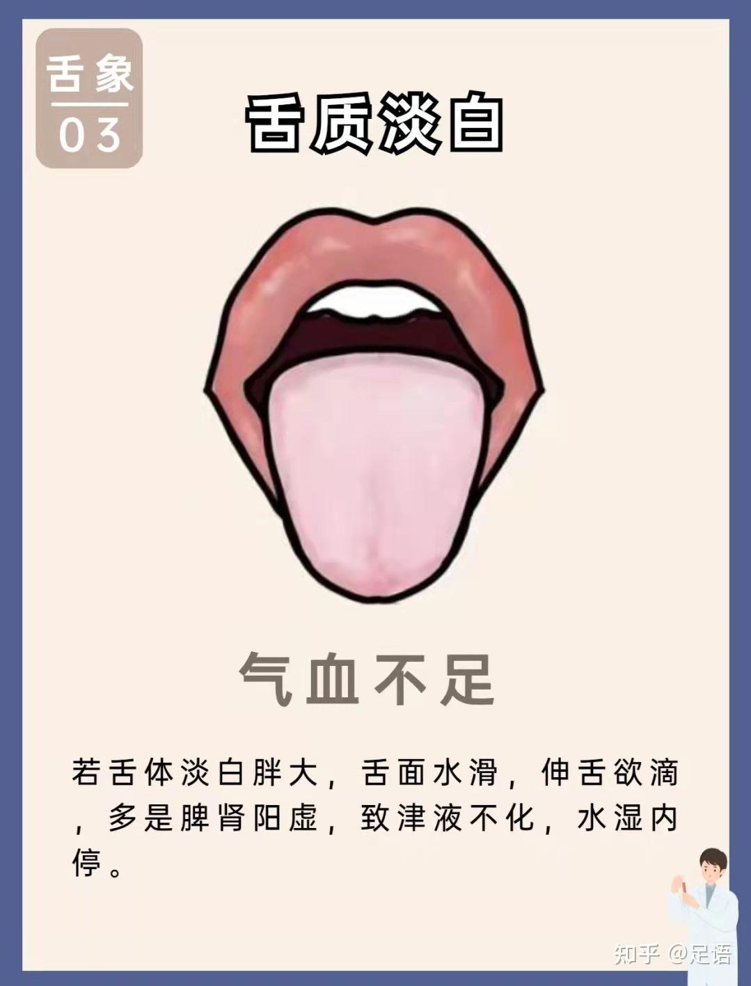 舌头红、厚、凹、凸都是病！舌红有热 舌厚有痰 舌凹有虚，舌鼓有堵 - 知乎