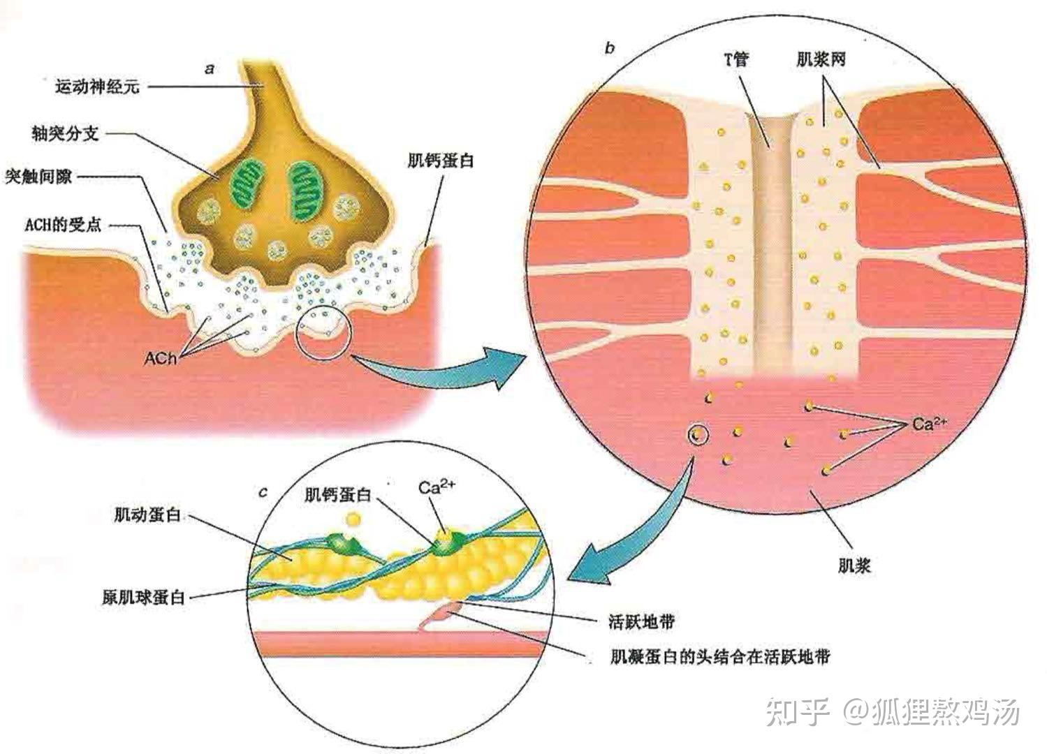 离心性肥大图片