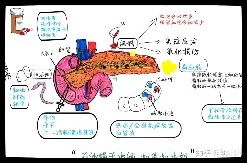 医学手绘:轻松记忆急性胰腺炎 - 知乎