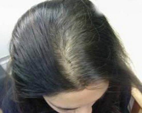 v2-c8c5673cd934d8a7bed7b4a987769498_r.jpg
