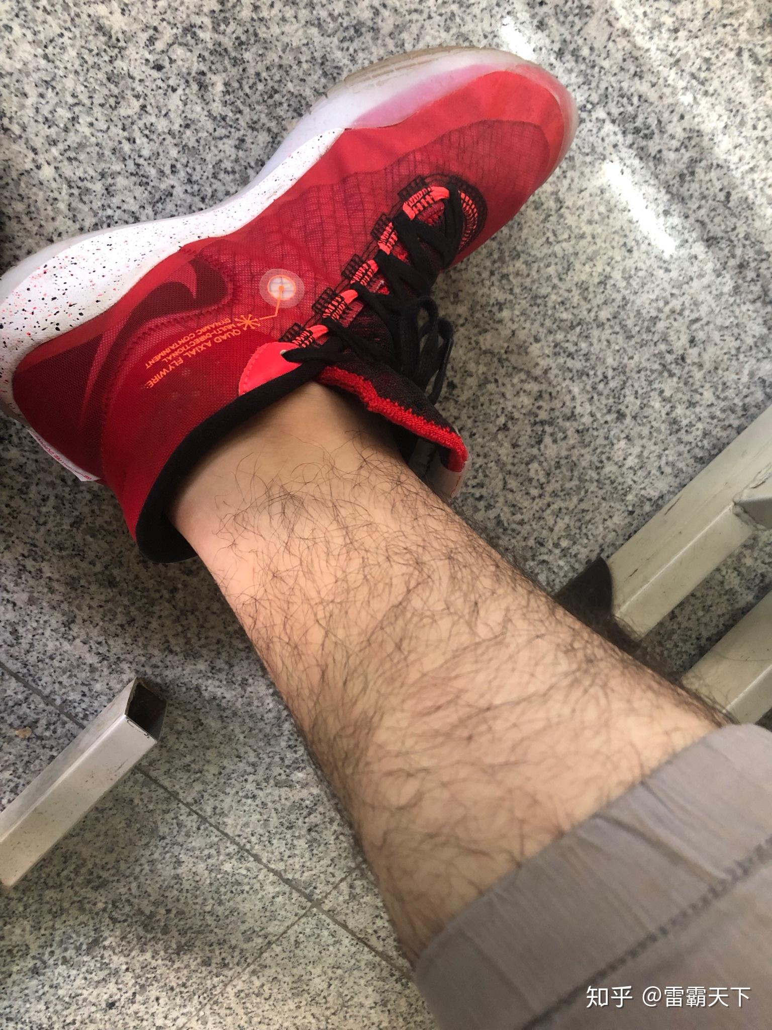 男生的腿毛应该怎么打理?