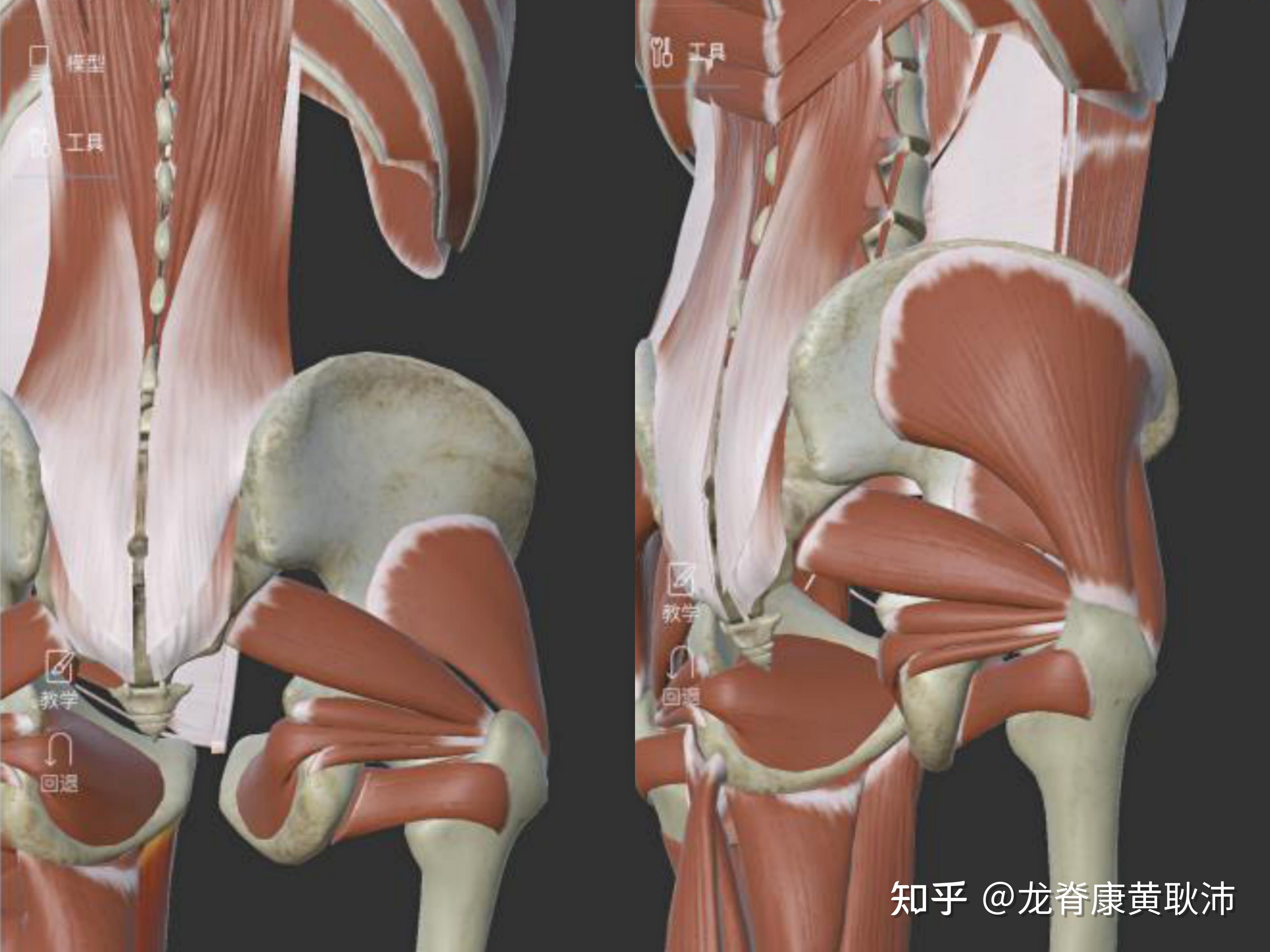 股骨大粗隆肌肉附着图片