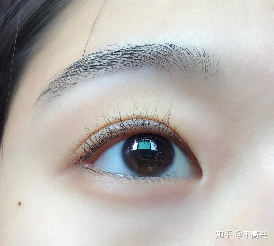 一觉睡醒之后单眼皮变双眼皮是一种怎样的体验