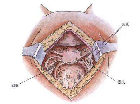 睾丸退化综合征图片